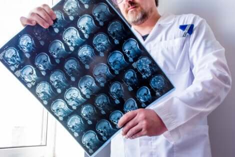 Un médecin qui examine des radiographies de la tête. 
