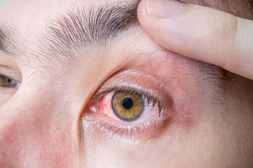 Mélanome oculaire : symptômes et causes