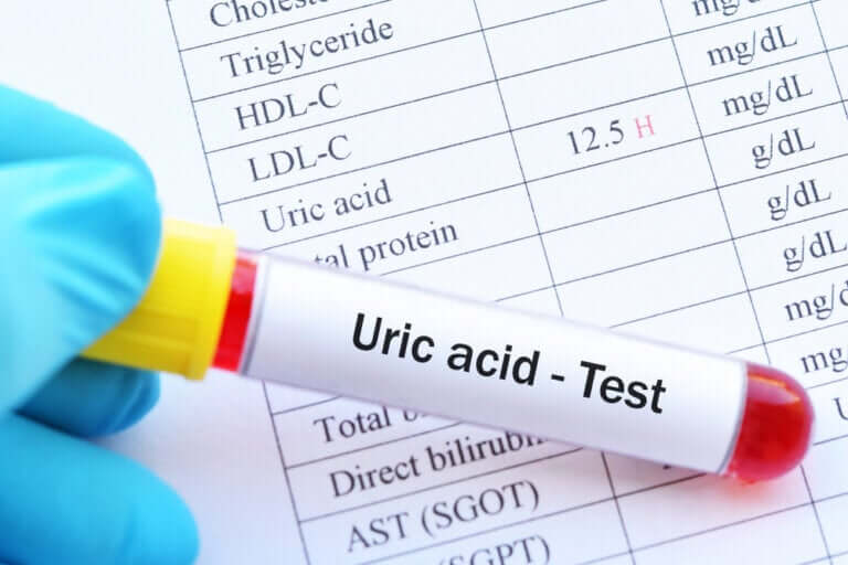Acide urique élevé : quelles sont les conséquences ?