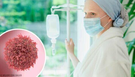 Une femme avec un cancer.