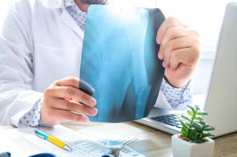 Un rhumatologue avec une radiographie.