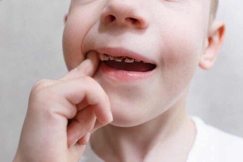 Un enfant avec un appareil dentaire qui se touche les dents. 