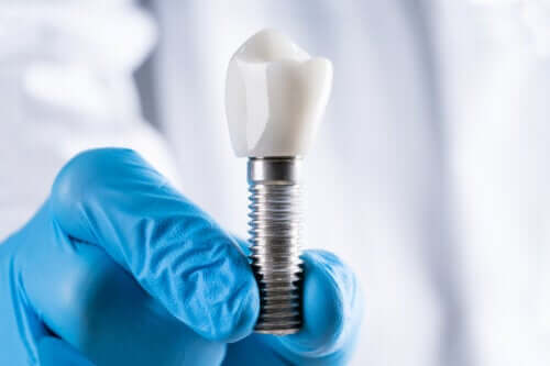 Péri-implantite : causes, symptômes et prévention