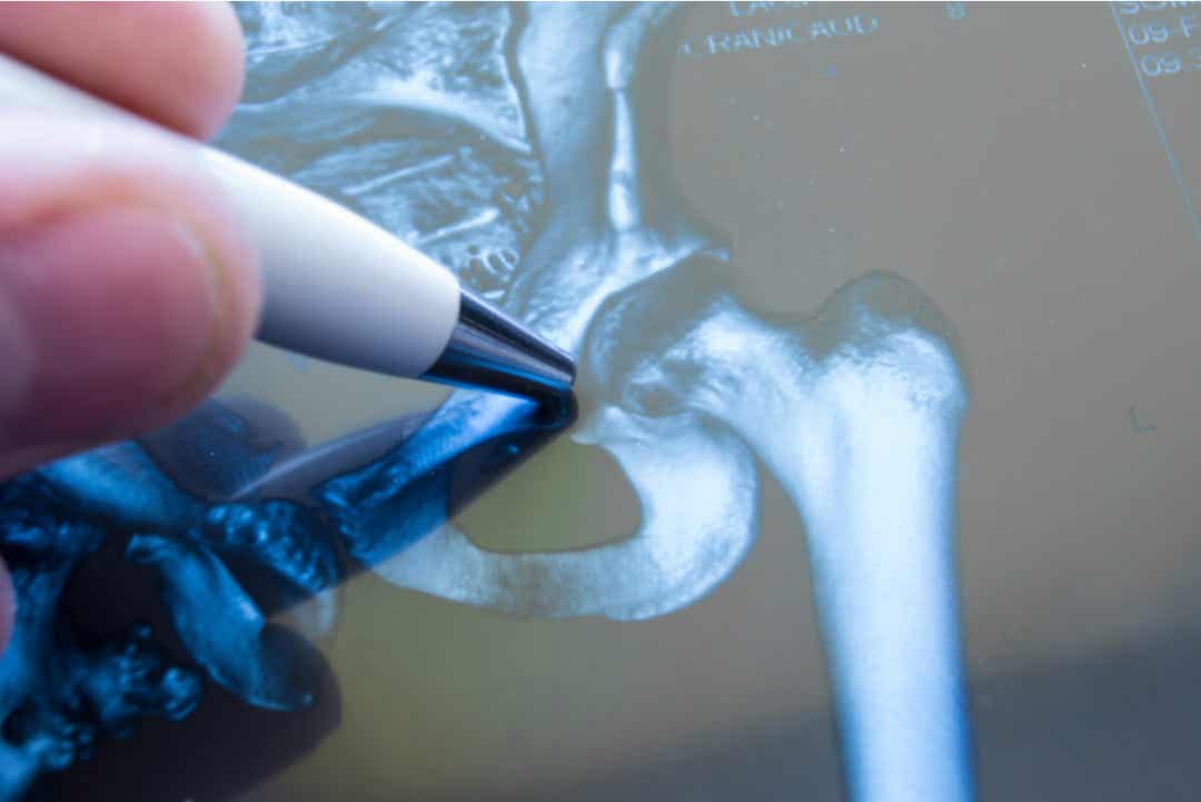 Une radiographie.