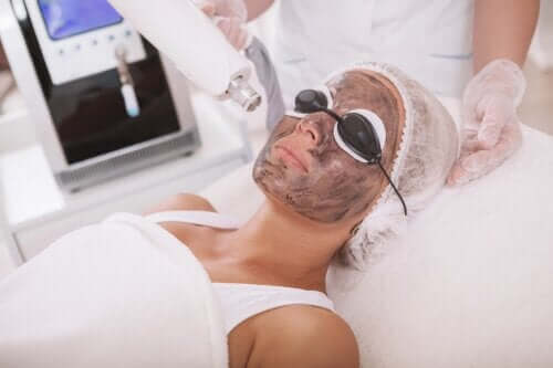 Peeling au laser de carbone : processus et soins