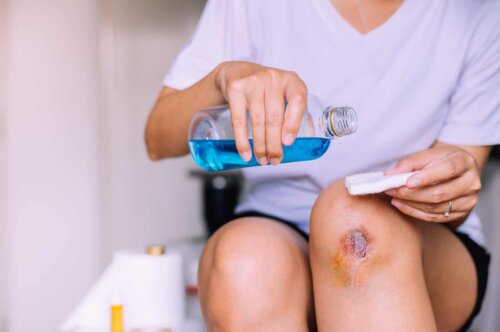Une blessure infectée.