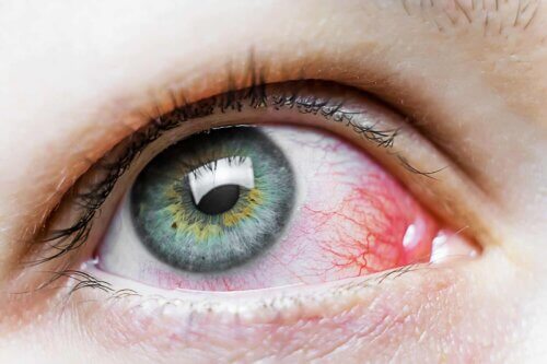 Avoir les yeux rouges.