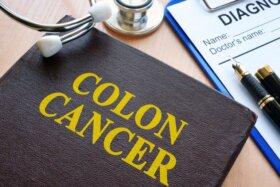 Journée mondiale du cancer du côlon : faites-vous dépister !