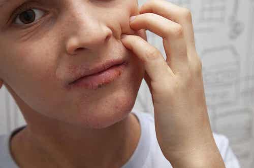 Les causes du visage asymétrique.