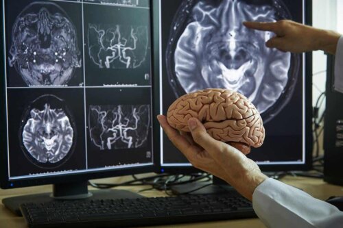 Étude du cerveau.