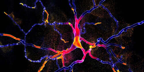 Une nouvelle technique pour différencier la maladie de Parkinson et l'atrophie multisystémique