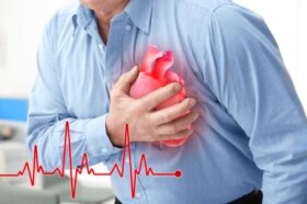 Le syndrome de Brugada, l'une des principales causes de mort subite