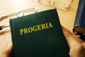 Syndrome de Werner : lorsque nous vieillissons trop vite