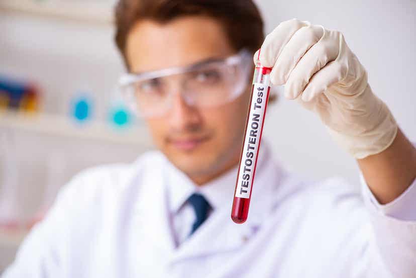 Test de testostérone.