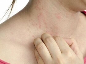 5 symptômes peu connus du diabète