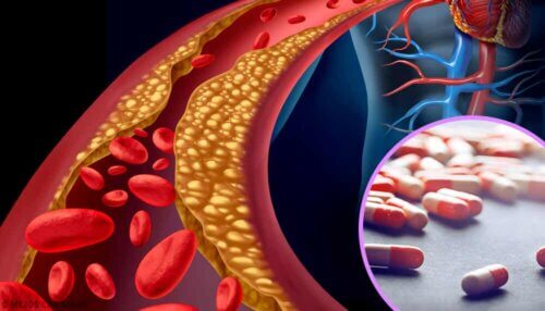 Outre le traitement traditionnel à base de médicaments et de compléments, il est recommandé de faire du sport et de suivre une alimentation équilibrée.