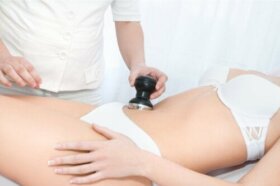 Ventousothérapie : qu'est-ce que c'est et quels sont ses bienfaits ?