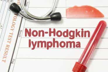 Lymphome non Hodgkinien : causes et traitement