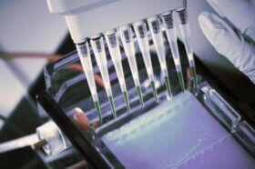 Qu'est-ce qu'un test d'immunofixation et à quoi sert-il ?