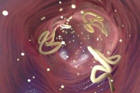 Éliminez les parasites intestinaux avec de l'ail et des graines de citrouille