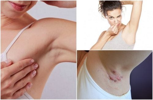 5 façons dont les aisselles mettent en garde contre la santé