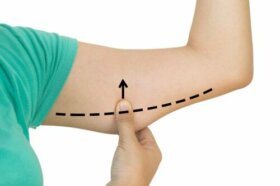 3 exercices pour affiner les bras