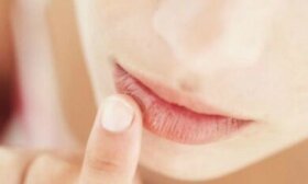 6 remèdes maison pour les lèvres gonflées
