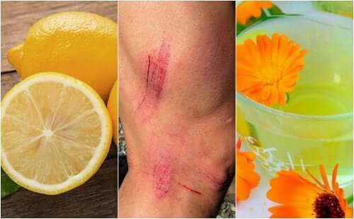 7 remèdes naturels pour soigner les égratignures sur la peau
