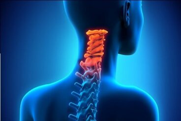 Comment prévenir l'arthrose cervicale ?