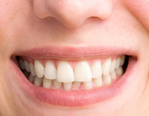 Les meilleures clés pour obtenir un sourire parfait