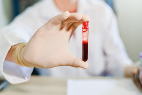 Quelle est la différence entre le sérum et le plasma sanguin ?