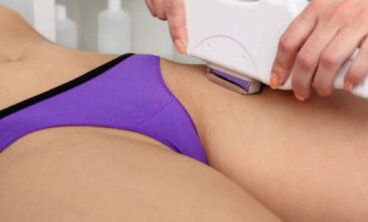 Épilation du maillot : bienfaits et techniques