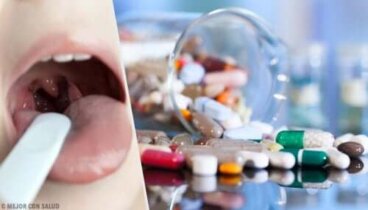 Le traitement de l'amygdalite aiguë