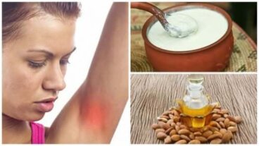 Aisselles irritées : les 7 meilleurs remèdes maison