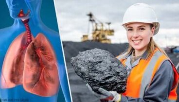 Anthracose : la maladie des mineurs de charbon