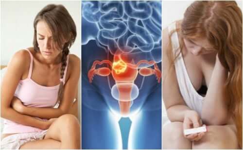 4 faits importants sur les fibromes utérins