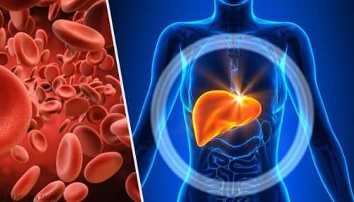 Hémochromatose : causes, symptômes et diagnostic