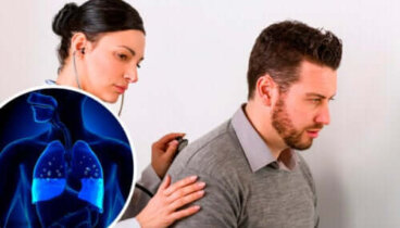 Le syndrome de détresse respiratoire aiguë