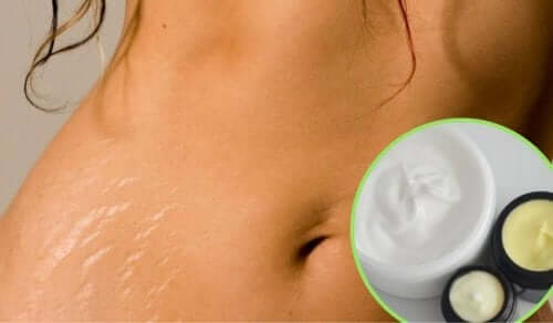 8 remèdes maison pour réduire les vergetures