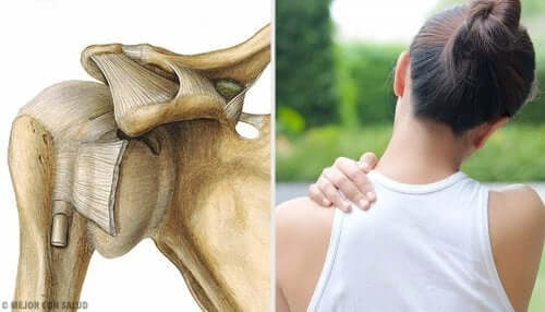 L'articulation de l'épaule, un appareil complexe