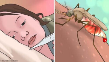 Fièvre jaune : causes, symptômes et traitement