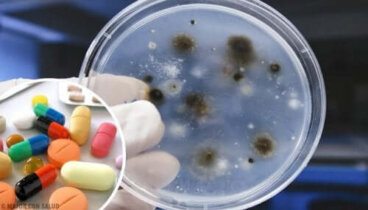 Le traitement de l'aspergillose