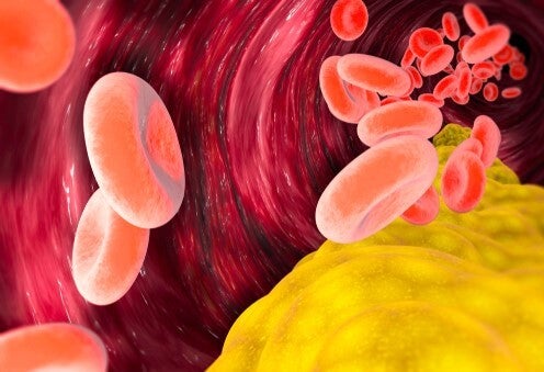 Le cholestérol VLDL est-il nocif ?