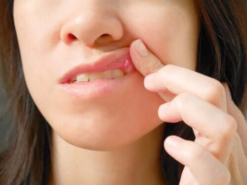 Qu’est-ce qu’un fibrome buccal et comment affecte-t-il la santé de la bouche ?