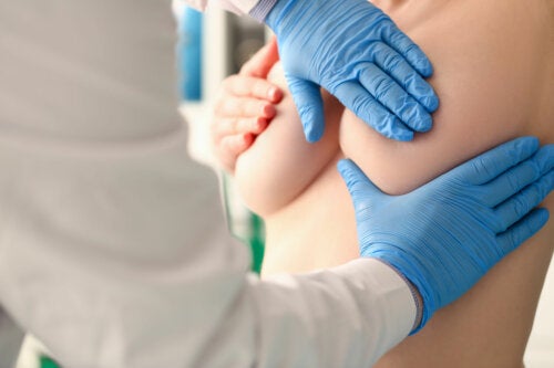 Hyperplasie mammaire : types, causes et traitements
