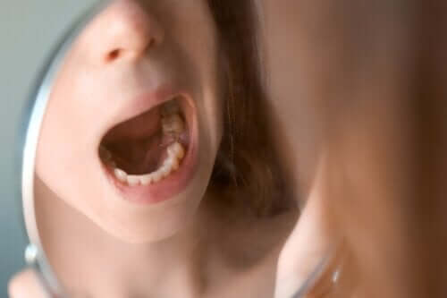 Papillome buccal : signes et prévention