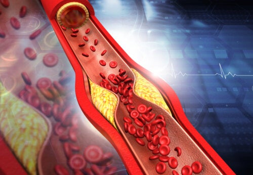Symptômes et conseils pour augmenter le taux de cholestérol HDL