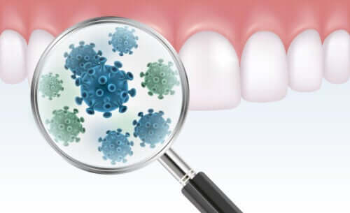 Tout ce que vous devez savoir sur la plaque bactérienne dentaire