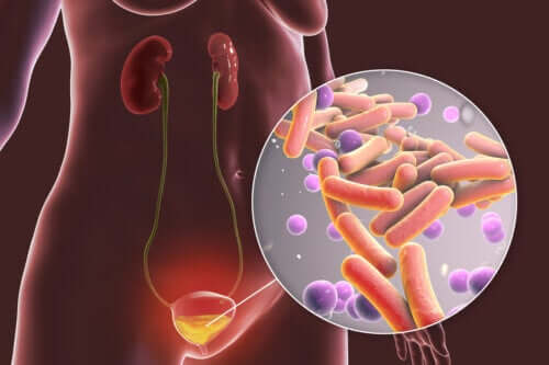 Bactéries dans l'urine : 4 causes et traitements