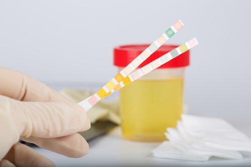 Le pH de l’urine, qu’est-ce que c’est ?